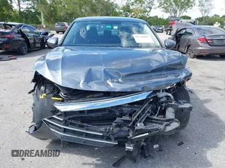 2021 Volkswagen Jetta S z VIN 3VWC57BU7MM013061, wystawiony jako IAAI lot #42148885 z przebiegiem 47 367 mil mil oraz . Historia ofert i sprzedaży dostępna na DreamBid. Obrazek 13.