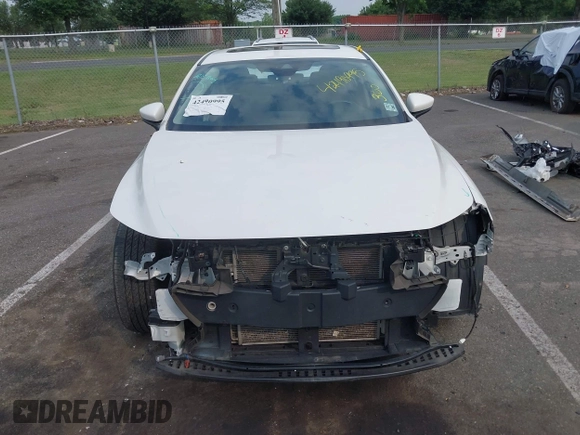 2021 Mazda 3 Preferred with VIN JM1BPACL4M1311415, listed as a IAAI auction lot 42490995 with 38,015 mi miles and . Bid and sale history available at DreamBid. Image 17.