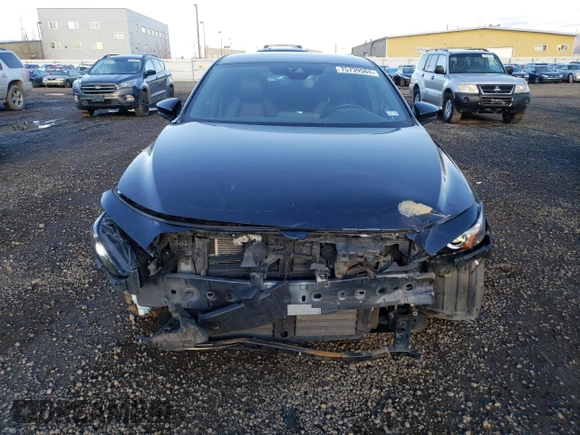 2022 Mazda Mazda3 Hatchback with VIN JM1BPALM2L1158704, listed as a Copart auction lot 75739504 with 79,588 mi miles and Salvage Title. Bid and sale history available at carsss.com. Image 5.