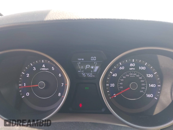 2016 Hyundai Elantra SE with VIN 5NPDH4AE2GH732722, listed as a IAAI auction lot 42408893 with 76,000 mi miles and . Bid and sale history available at DreamBid. Image 7.