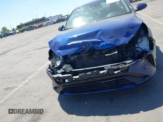 2022 Kia Forte LXS z VIN 3KPF24AD1NE454494, wystawiony jako IAAI lot #42077580 z przebiegiem 53 679 mil mil oraz . Historia ofert i sprzedaży dostępna na DreamBid. Obrazek 12.