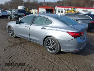 2015 Acura TLX V6 Advance with VIN 19UUB3F70FA006340, listed as a IAAI auction lot 41501312 with 151,517 mi miles. Bid and sale history available at carsss.com. Image 3.