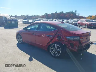 2017 Hyundai Elantra SE z VIN 5NPD84LF4HH101798, wystawiony jako IAAI lot #40700630 z przebiegiem 86 404 mil mil oraz . Historia ofert i sprzedaży dostępna na DreamBid. Obrazek 3.