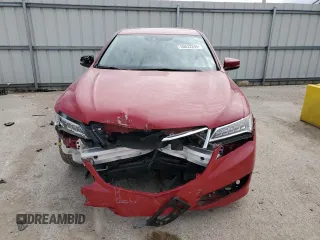 2017 Acura TLX Technology with VIN 19UUB1F53HA006760, listed as a Copart auction lot 50632845 with 94,161 mi miles and Salvage Title. Bid and sale history available at DreamBid. Image 5.