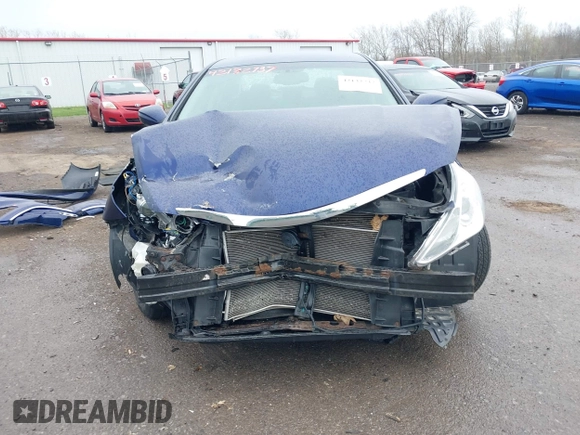 2013 Hyundai Sonata GLS z VIN 5NPEB4AC7DH712823, wystawiony jako IAAI lot #42132737 z przebiegiem 108 993 mil mil oraz . Historia ofert i sprzedaży dostępna na DreamBid. Obrazek 12.
