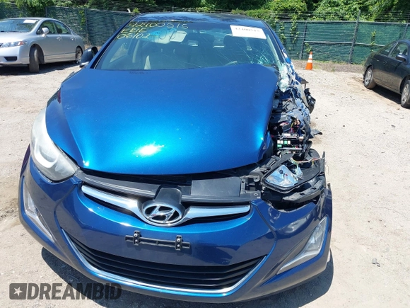 2015 Hyundai Elantra SE с VIN 5NPDH4AE8FH598863, выставлен на аукционе IAAI как лот 42400515 с пробегом 162 820 миль миль и . История ставок и продаж доступна на DreamBid. Изображение 6.