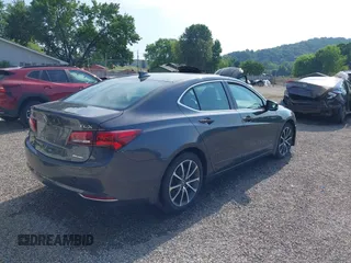 2016 Acura TLX Advance with VIN 19UUB3F71GA000306, listed as a IAAI auction lot 42579640 with 150,764 mi miles and . Bid and sale history available at DreamBid. Image 4.