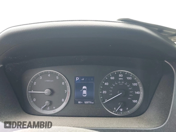 2017 Hyundai Sonata Sport with VIN 5NPE34AF2HH562729, listed as a IAAI auction lot 41941388 with 123,770 mi miles. Bid and sale history available at carsss.com. Image 7.