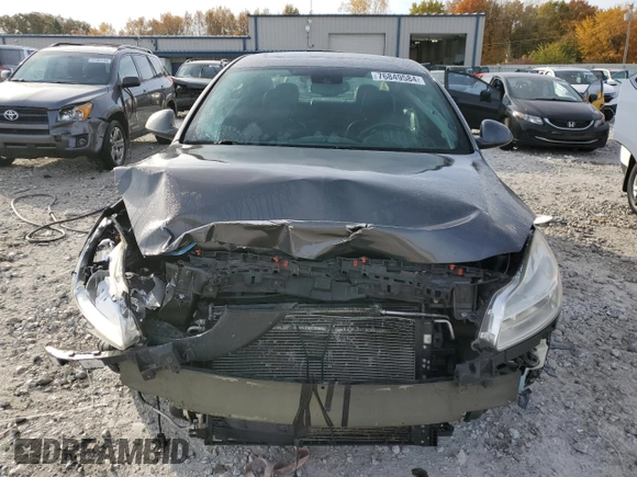 2011 Buick Regal CXL Turbo TO3 with VIN W04GX5GVXB1083470, listed as a Copart auction lot 76849584 with 186,493 mi miles and Clean Title. Bid and sale history available at carsss.com. Image 5.