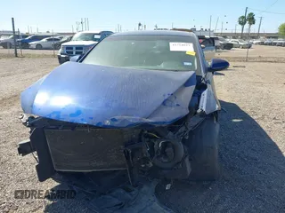 2018 Hyundai Elantra SEL with VIN 5NPD84LF4JH343609, listed as a IAAI auction lot 41754927 with 79,016 mi miles and . Bid and sale history available at DreamBid. Image 12.