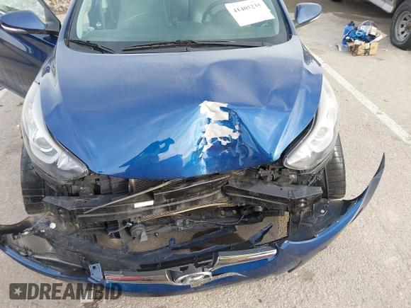 2015 Hyundai Elantra SE z VIN 5NPDH4AE0FH630351, wystawiony jako IAAI lot #41405235 z przebiegiem 122 199 mil mil oraz . Historia ofert i sprzedaży dostępna na DreamBid. Obrazek 12.