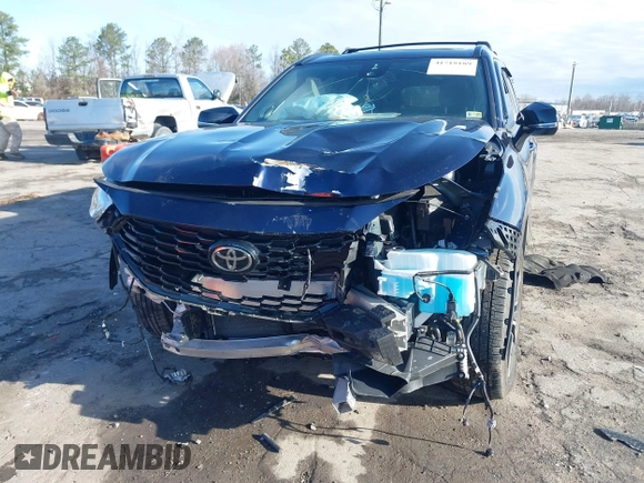 2021 Toyota Highlander XSE with VIN 5TDJZRBH0MS121857, listed as a IAAI auction lot 41718189 with Not provided miles and . Bid and sale history available at DreamBid. Image 6.
