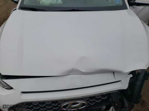 2019 Hyundai Kona Limited with VIN KM8K3CA54KU376039, listed as a Copart auction lot 82322634 with 62,025 mi miles and Salvage Title. Bid and sale history available at carsss.com. Image 14.