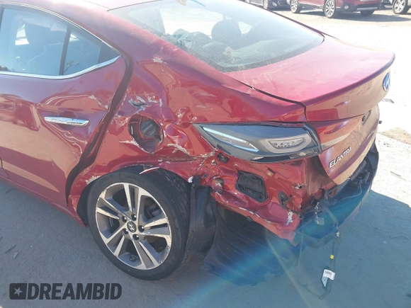 2017 Hyundai Elantra SE z VIN 5NPD84LF4HH101798, wystawiony jako IAAI lot #40700630 z przebiegiem 86 404 mil mil oraz . Historia ofert i sprzedaży dostępna na DreamBid. Obrazek 6.