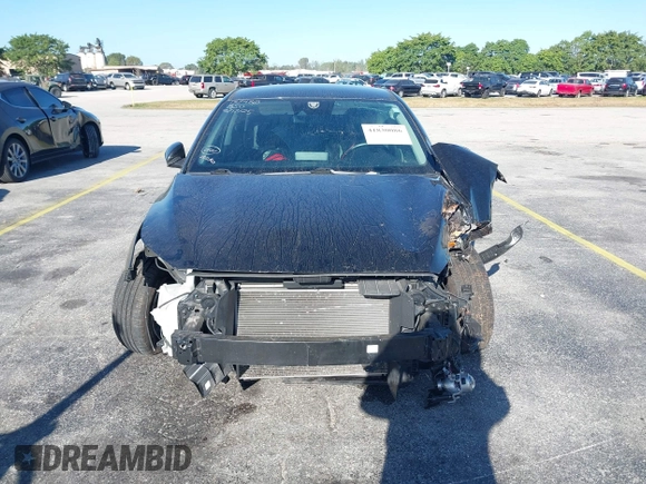 2022 Kia Forte LXS z VIN 3KPF24AD2NE439180, wystawiony jako IAAI lot #41830086 z przebiegiem 39 128 mil mil oraz . Historia ofert i sprzedaży dostępna na DreamBid. Obrazek 6.
