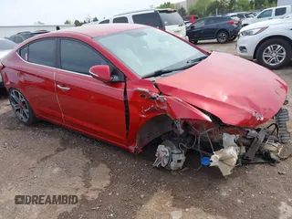 2017 Hyundai Elantra SE z VIN 5NPD84LF7HH004515, wystawiony jako IAAI lot #42001637 z przebiegiem 98 359 mil mil oraz . Historia ofert i sprzedaży dostępna na DreamBid. Obrazek 1.