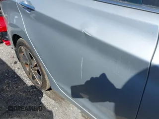 2015 Hyundai Elantra SE z VIN 5NPDH4AE4FH610961, wystawiony jako IAAI lot #42134698 z przebiegiem 72 591 mil mil oraz . Historia ofert i sprzedaży dostępna na DreamBid. Obrazek 18.