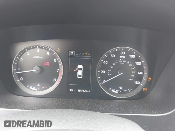 2015 Hyundai Sonata Limited with VIN 5NPE34AFXFH041898, listed as a IAAI auction lot 41929114 with 151,429 mi miles and . Bid and sale history available at carsss.com. Image 7.