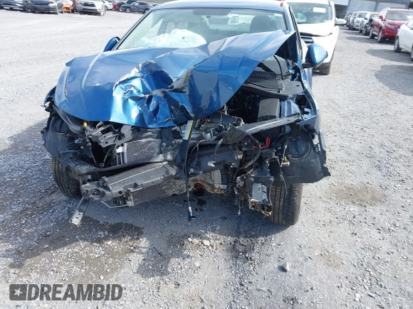 2021 Volkswagen Jetta S z VIN 3VWC57BU0MM084554, wystawiony jako IAAI lot #41859293 z przebiegiem Nie podano mil oraz . Historia ofert i sprzedaży dostępna na DreamBid. Obrazek 11.