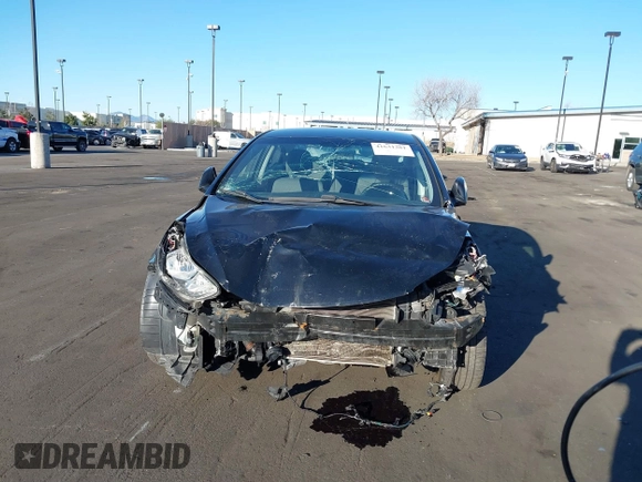 2016 Hyundai Elantra SE z VIN 5NPDH4AE0GH687456, wystawiony jako IAAI lot #41631381 z przebiegiem 122 318 mil mil oraz . Historia ofert i sprzedaży dostępna na DreamBid. Obrazek 6.