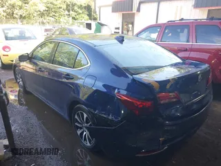 2015 Acura TLX Technology with VIN 19UUB1F55FA011570, listed as a IAAI auction lot 42437612 with 156,925 mi miles and . Bid and sale history available at DreamBid. Image 3.