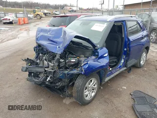 2020 Hyundai Venue SEL z VIN KMHRC8A32LU042779, wystawiony jako IAAI lot #41524933 z przebiegiem 111 579 mil mil oraz . Historia ofert i sprzedaży dostępna na DreamBid. Obrazek 18.