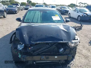 2021 Kia Forte FE z VIN 3KPF24AD6ME390032, wystawiony jako IAAI lot #41467915 z przebiegiem 43 654 mil mil oraz . Historia ofert i sprzedaży dostępna na DreamBid. Obrazek 13.