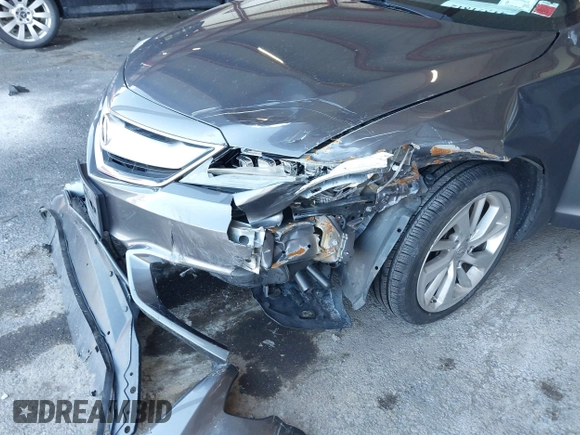 2018 Acura ILX with VIN 19UDE2F37JA000283, listed as a IAAI auction lot 41571812 with 79,843 mi miles and . Bid and sale history available at DreamBid. Image 6.