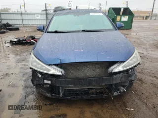 2020 Hyundai Elantra SEL z VIN 5NPD84LFXLH515922, wystawiony jako Copart lot #55400485 z przebiegiem 68 077 mil mil oraz Szkoda całkowita • Salvage title. Historia ofert i sprzedaży dostępna na DreamBid. Obrazek 5.