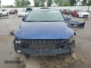 2017 Hyundai Elantra SE z VIN 5NPD84LF3HH183829, wystawiony jako Copart lot #58819665 z przebiegiem Nie podano mil oraz Czysty tytuł • Clean title. Historia ofert i sprzedaży dostępna na DreamBid. Obrazek 5.