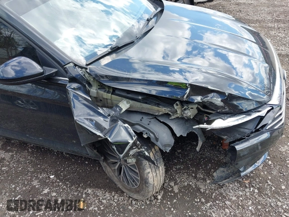 2021 Volkswagen Jetta S z VIN 3VWC57BU0MM035340, wystawiony jako IAAI lot #42045819 z przebiegiem 76 751 mil mil oraz . Historia ofert i sprzedaży dostępna na DreamBid. Obrazek 6.