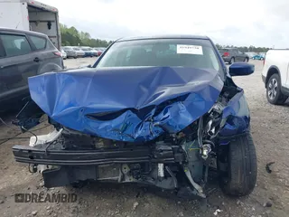 2018 Nissan Sentra S z VIN 3N1AB7AP7JY208339, wystawiony jako IAAI lot #41949758 z przebiegiem 53 265 mil mil oraz . Historia ofert i sprzedaży dostępna na DreamBid. Obrazek 13.