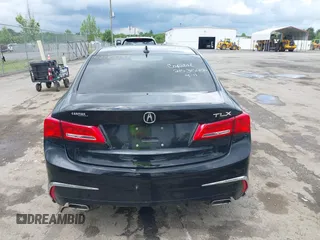 2018 Acura TLX z VIN 19UUB2F35JA009413, wystawiony jako IAAI lot #42189933 z przebiegiem 76 365 mil mil oraz . Historia ofert i sprzedaży dostępna na DreamBid. Obrazek 15.