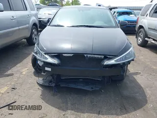 2020 Hyundai Elantra SEL z VIN 5NPD84LF9LH532517, wystawiony jako IAAI lot #42031456 z przebiegiem 37 611 mil mil oraz . Historia ofert i sprzedaży dostępna na DreamBid. Obrazek 6.