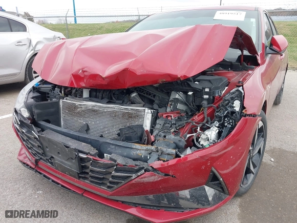 2021 Hyundai Elantra SEL with VIN KMHLN4AG2MU179394, listed as a IAAI auction lot 40919517 with 110,330 mi miles. Bid and sale history available at carsss.com. Image 6.