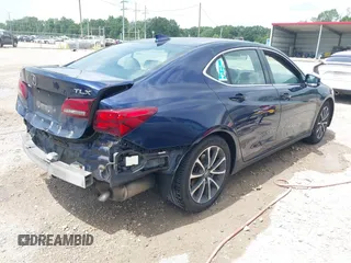 2015 Acura TLX Technology with VIN 19UUB2F54FA022730, listed as a IAAI auction lot 42590966 with 202,855 mi miles and . Bid and sale history available at DreamBid. Image 4.