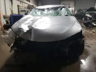 2017 Toyota Camry XLE with VIN 4T1BF1FK1HU352381, listed as a Copart auction lot 84551574 with 40,663 mi miles and Salvage Title. Bid and sale history available at DreamBid. Image 5.