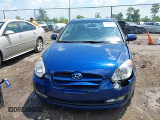 2011 Hyundai Accent SE with VIN KMHCN3AC6BU194520, listed as a IAAI auction lot 42664778 with 170,197 mi miles and . Bid and sale history available at DreamBid. Image 12.