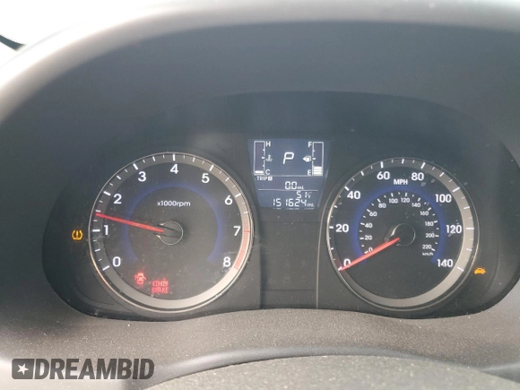 2017 Hyundai Accent SE with VIN KMHCT4AEXHU193697, listed as a Copart auction lot 45313315 with 151,624 mi miles and Salvage Title. Bid and sale history available at carsss.com. Image 9.