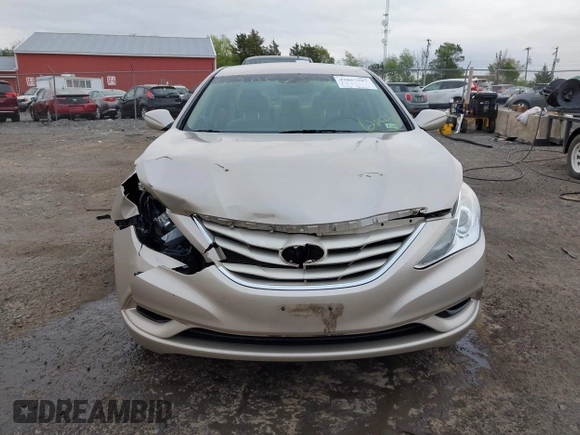 2011 Hyundai Sonata GLS with VIN 5NPEB4AC5BH284652, listed as a IAAI auction lot 42067587 with 155,310 mi miles and . Bid and sale history available at DreamBid. Image 6.