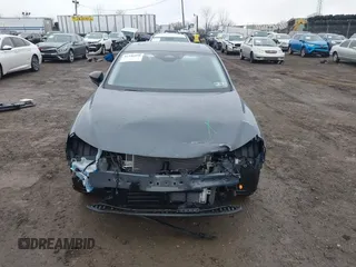 2025 Mazda 3 S Carbon Edition with VIN JM1BPBCM4S1760993, listed as a IAAI auction lot 41446098 with 102 mi miles and . Bid and sale history available at DreamBid. Image 6.