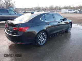 2015 Acura TLX Advance z VIN 19UUB3F72FA010258, wystawiony jako IAAI lot #41208796 z przebiegiem 158 125 mil mil oraz . Historia ofert i sprzedaży dostępna na DreamBid. Obrazek 4.