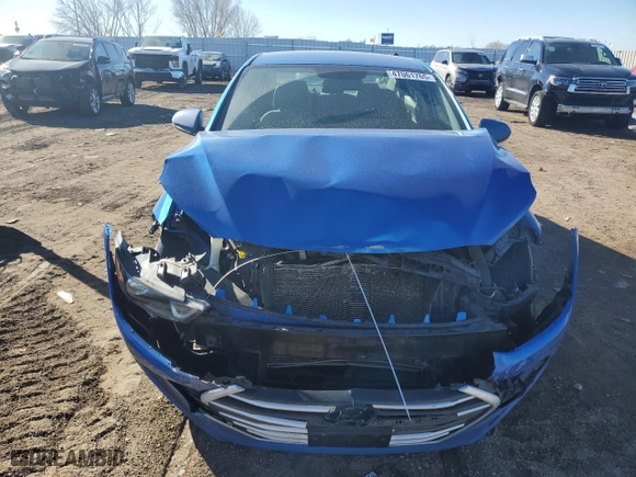 2017 Hyundai Elantra SE with VIN KMHD74LF2HU096041, listed as a Copart auction lot 47061765 with 97,943 mi miles and Salvage Title. Bid and sale history available at carsss.com. Image 5.