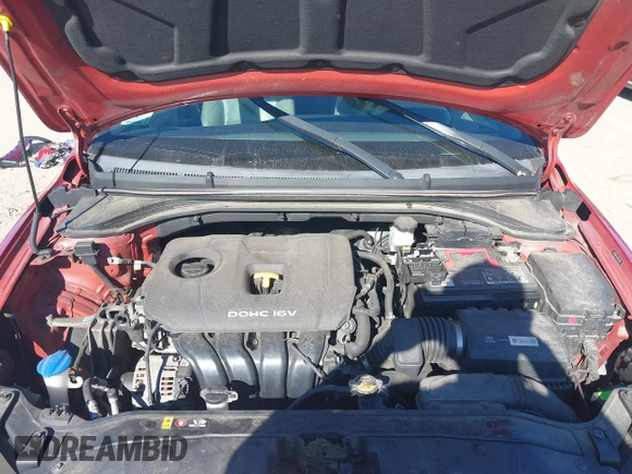 2017 Hyundai Elantra SE z VIN 5NPD84LF4HH101798, wystawiony jako IAAI lot #40700630 z przebiegiem 86 404 mil mil oraz . Historia ofert i sprzedaży dostępna na DreamBid. Obrazek 10.