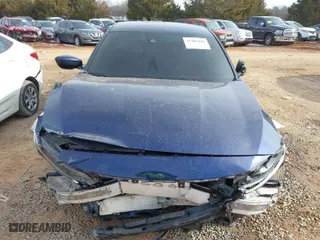 2020 Honda Accord Sedan LX with VIN 1HGCV1F13LA099675, listed as a IAAI auction lot 41405450 with 79,106 mi miles. Bid and sale history available at carsss.com. Image 6.