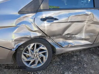 2024 Hyundai Elantra SEL z VIN KMHLM4DG8RU659817, wystawiony jako IAAI lot #41875167 z przebiegiem 31 674 mil mil oraz . Historia ofert i sprzedaży dostępna na DreamBid. Obrazek 6.