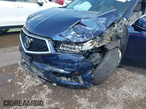 2017 Acura MDX Advance z VIN 5FRYD3H98HB010847, wystawiony jako IAAI lot #42391406 z przebiegiem 93 063 mil mil oraz . Historia ofert i sprzedaży dostępna na DreamBid. Obrazek 6.