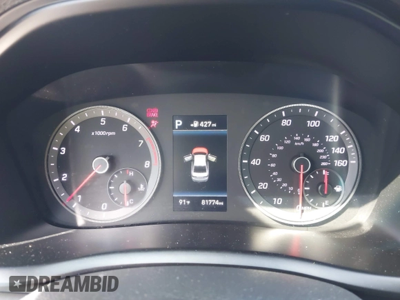 2018 Hyundai Sonata SEL with VIN 5NPE34AFXJH653446, listed as a IAAI auction lot 40011540 with 81,774 mi miles and . Bid and sale history available at DreamBid. Image 7.