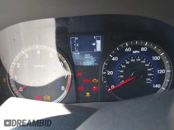 2017 Hyundai Accent SE z VIN KMHCT4AE8HU232920, wystawiony jako IAAI lot #42214731 z przebiegiem 116 586 mil mil oraz . Historia ofert i sprzedaży dostępna na DreamBid. Obrazek 7.