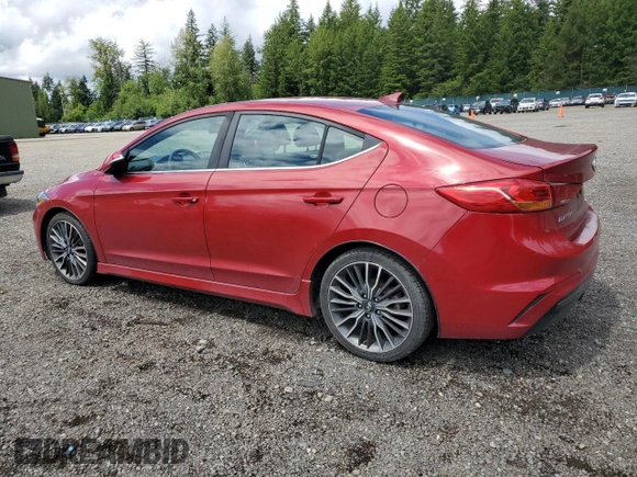 2018 Hyundai Elantra Sport с VIN KMHD04LB4JU523758, выставлен на аукционе Copart как лот 58979395 с пробегом 137 505 миль миль и Чистый • Clean title. История ставок и продаж доступна на DreamBid. Изображение 2.